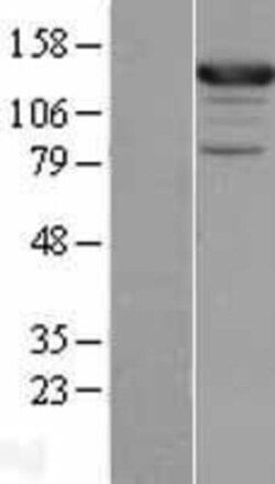 Novus Biologicals&trade;&nbsp;ASAP1 Overexpression Lysate