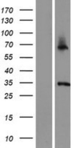 Novus Biologicals&trade;&nbsp;ASB11 Overexpression Lysate