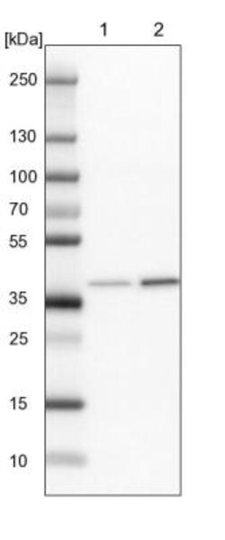 anti-ASB11, Polyclonal, Novus Biologicals 0.1mL; Unlabeled:Antibodies,