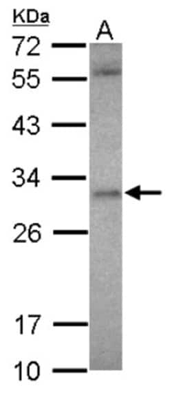 ASB12 Antibody, Novus Biologicals 0.1 mL | Buy Online | Novus Biologicals | Fisher Scientific