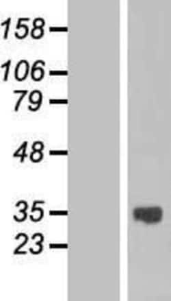 Novus Biologicals™ ASB13 Overexpression Lysate
