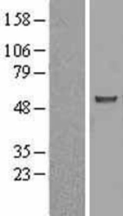 Novus Biologicals&trade;&nbsp;ASB3 Overexpression Lysate
