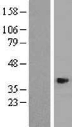 Novus Biologicals™ ASB4 Overexpression Lysate