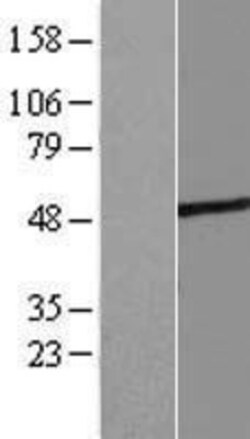 Novus Biologicals&trade;&nbsp;ASB4 Overexpression Lysate