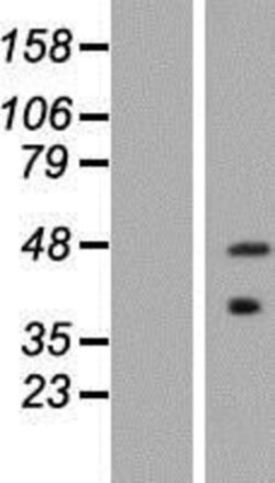 Novus Biologicals™ ASB5 Overexpression Lysate