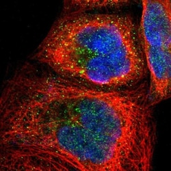 ASB6 Antibody, Novus Biologicals 0.1mL; Unlabeled:Antibodies, Polyclonal
