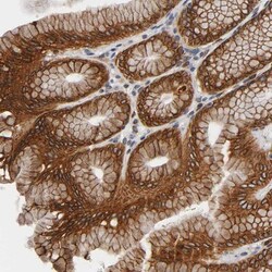 ASB6 Antibody, Novus Biologicals 0.1mL; Unlabeled:Antibodies, Polyclonal