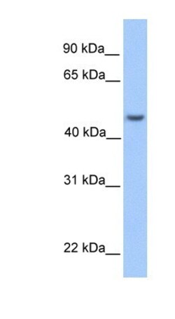 ASB6 Antibody, Novus Biologicals:Antibodies:Primary Antibodies