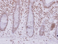 ASB7 Antibody, Novus Biologicals 0.1mL; Unlabeled:Antibodies, Polyclonal