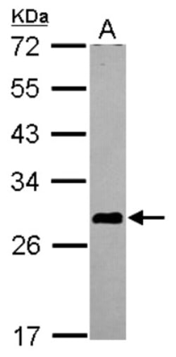ASB7 Antibody, Novus Biologicals 0.1mL; Unlabeled:Antibodies, Polyclonal
