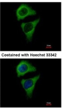 ASB8 Antibody, Novus Biologicals 0.1mL; Unlabeled:Antibodies, Polyclonal