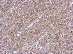 ASB8 Antibody, Novus Biologicals 0.1mL; Unlabeled:Antibodies, Polyclonal