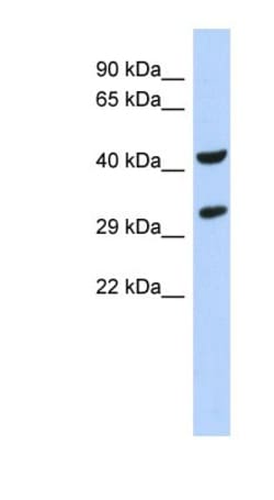ASB8 Antibody, Novus Biologicals 100&mu;L; Unlabeled:Antibodies, Polyclonal