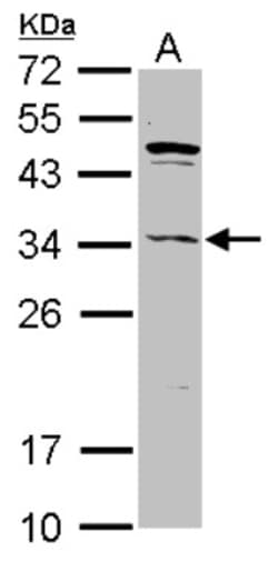 ASB8 Antibody, Novus Biologicals 0.1mL; Unlabeled:Antibodies, Polyclonal