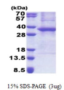 Novus Biologicals&trade;&nbsp;Recombinant Human ASB8 His Protein