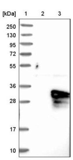 ASB9 Antibody, Novus Biologicals:Antibodies:Primary Antibodies