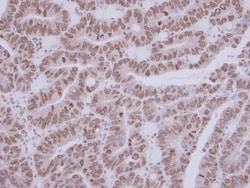 ASC1 Antibody, Novus Biologicals 0.1mL; Unlabeled:Antibodies, Polyclonal