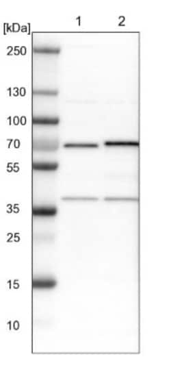 ASC1 Antibody, Novus Biologicals 25 &mu;L; Unlabeled:Antibodies, Polyclonal