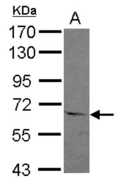 ASC1 Antibody, Novus Biologicals 0.1mL; Unlabeled:Antibodies, Polyclonal