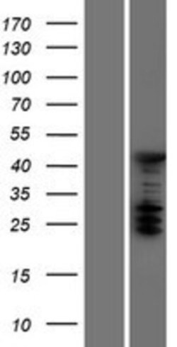 Novus Biologicals&trade;&nbsp;ASC1 Overexpression Lysate
