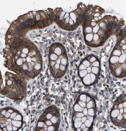 ASC1 Antibody, Novus Biologicals 25 &mu;L; Unlabeled:Antibodies, Polyclonal
