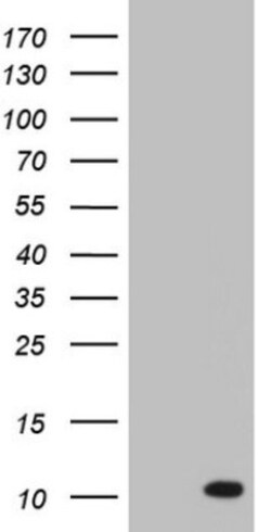 ASC2 Antibody (OTI9C10), Novus Biologicals 0.1mL; Unlabeled:Antibodies,