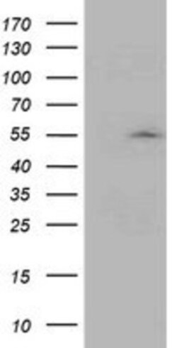 ASCC1 Antibody (OTI6G5), Novus Biologicals 0.1mL; Unlabeled:Antibodies,