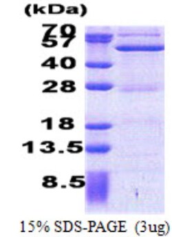 Novus Biologicals&trade;&nbsp;Recombinant Human ASCC1 His Protein