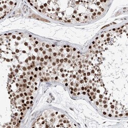 ASCC3L1 Antibody, Novus Biologicals:Antibodies:Primary Antibodies