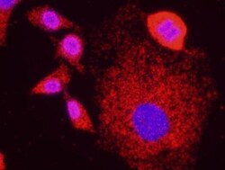 ASCIZ Antibody, Novus Biologicals 0.1mg; Unlabeled:Antibodies, Polyclonal