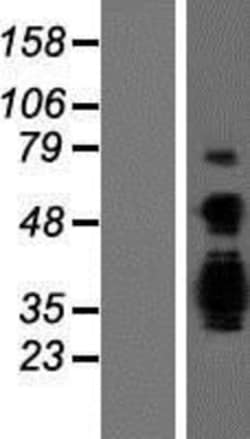 Novus Biologicals&trade;&nbsp;ASCL3 Overexpression Lysate
