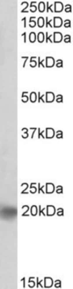 ASCL3 Antibody, Novus Biologicals 0.1mg; Unlabeled:Antibodies, Polyclonal