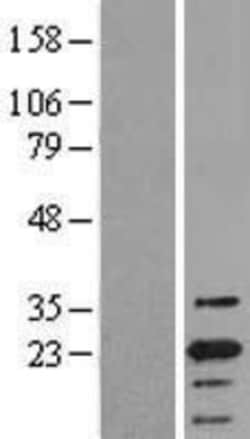 Novus Biologicals&trade;&nbsp;ASC/TMS1 Overexpression Lysate