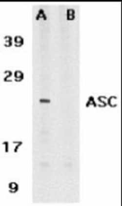 Novus Biologicals ASC/TMS1 Antibody Blocking Peptide 0.05 mg | Buy Online | Novus Biologicals&trade; | Fisher Scientific
