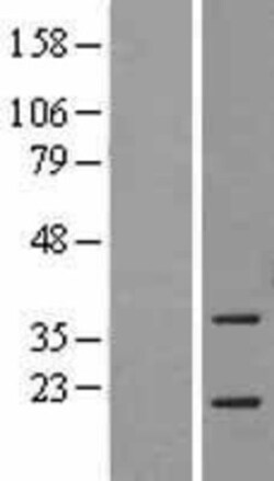 Novus Biologicals™ ASF1a Overexpression Lysate