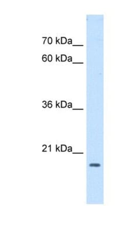 ASF1b Antibody, Novus Biologicals:Antibodies:Primary Antibodies