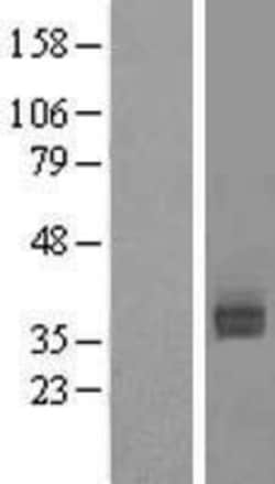 Novus Biologicals&trade;&nbsp;Asialoglycoprotein Receptor 2 Overexpression Lysate