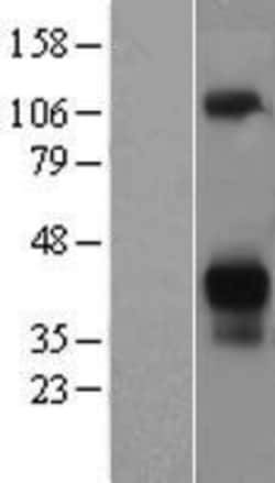 Novus Biologicals&trade;&nbsp;Asialoglycoprotein Receptor 2 Overexpression Lysate