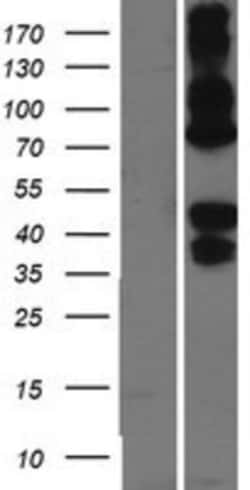 Novus Biologicals Asialoglycoprotein Receptor 2 Overexpression Lysate 0.1 mg | Buy Online | Novus Biologicals&trade; | Fisher Scientific