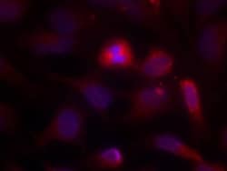 ASK1 Antibody, Novus Biologicals:Antibodies:Primary Antibodies