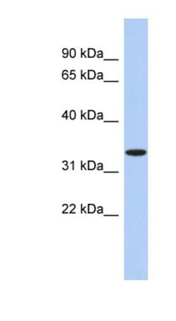 ASPA Antibody, Novus Biologicals 100&mu;L; Unlabeled:Antibodies, Polyclonal