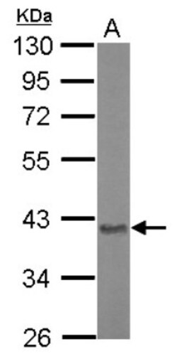 ASPA Antibody, Novus Biologicals 0.1mL; Unlabeled:Antibodies, Polyclonal