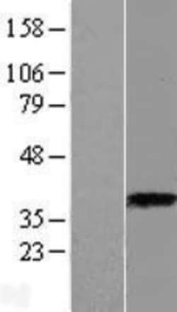 Novus Biologicals™ ASPA Overexpression Lysate