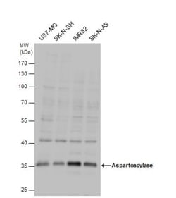 ASPA Antibody, Novus Biologicals 0.1mg; Unlabeled:Antikroppar
