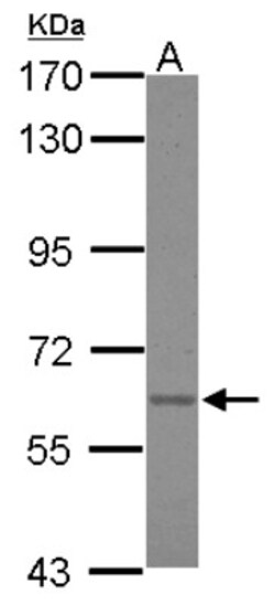 Asparagine synthetase Antibody, Novus Biologicals 0.1mL; Unlabeled:Antibodies,