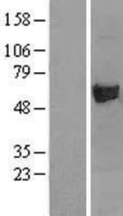 Novus Biologicals™ Asparagine synthetase Overexpression Lysate