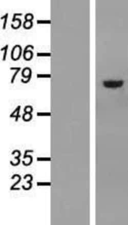 Novus Biologicals™ Asparagine synthetase Overexpression Lysate
