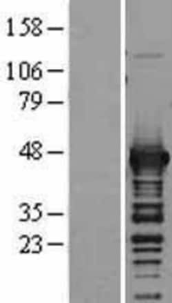 Novus Biologicals&trade;&nbsp;Aspartate Aminotransferase Overexpression Lysate