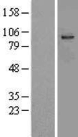 Novus Biologicals&trade;&nbsp;Aspartate beta hydroxylase Overexpression Lysate