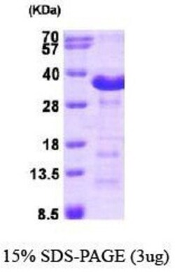 Novus Biologicals&trade;&nbsp;Recombinant Human Aspartate beta hydroxylase His Protein